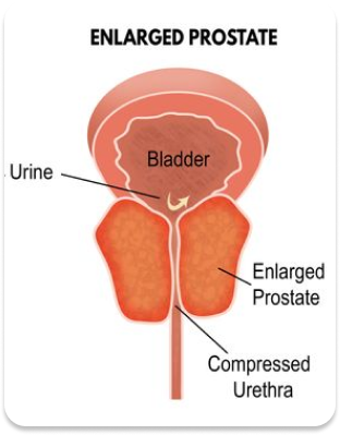 Prostate Image